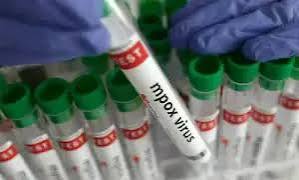 First infant battling mpox dies in Karachi hospital